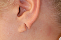 ear-2-before