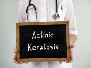 What_Do_Actinic_Keratoses_Look_Like_637932058942336680