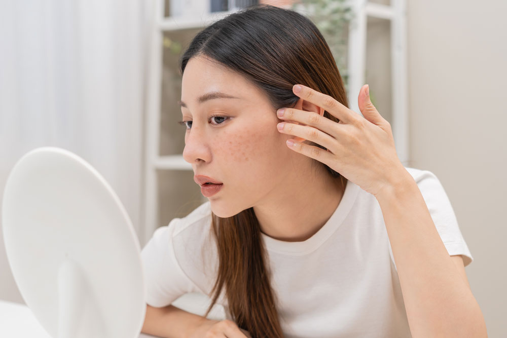 say-goodbye-to-redness-and-sun-damage-ipl-treatments-worcester-derm